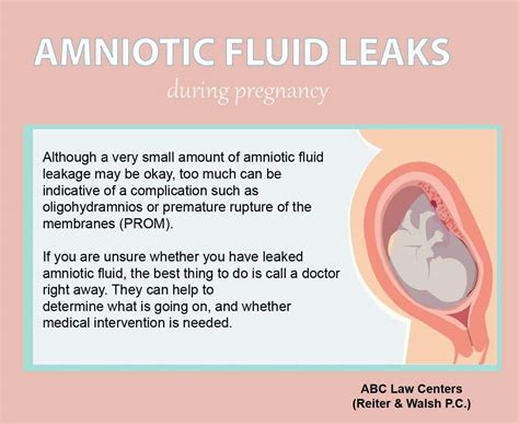 straw colored amniotic fluid|Signs Of Leaking Amniotic Fluid Vs. Discharge: The。